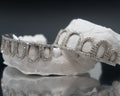 Open Face Grillz
